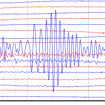 Seismograph Image
